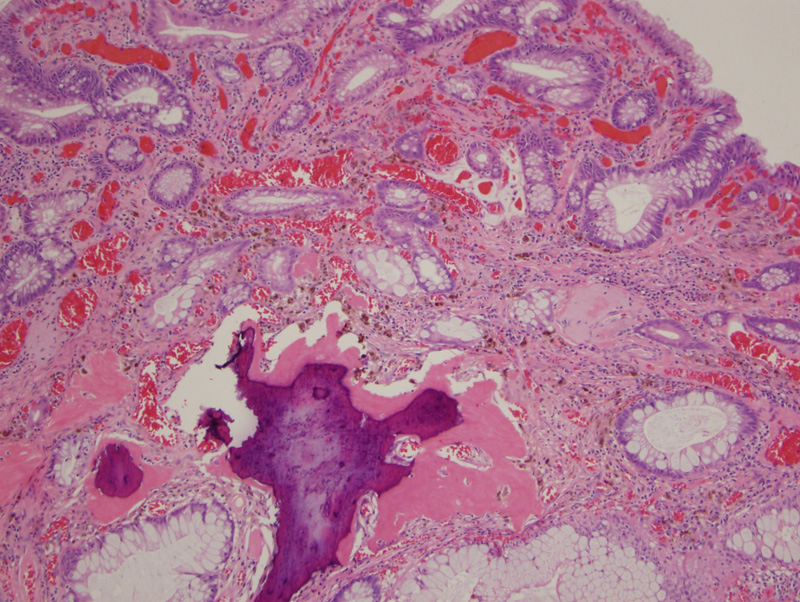 Pathology Image